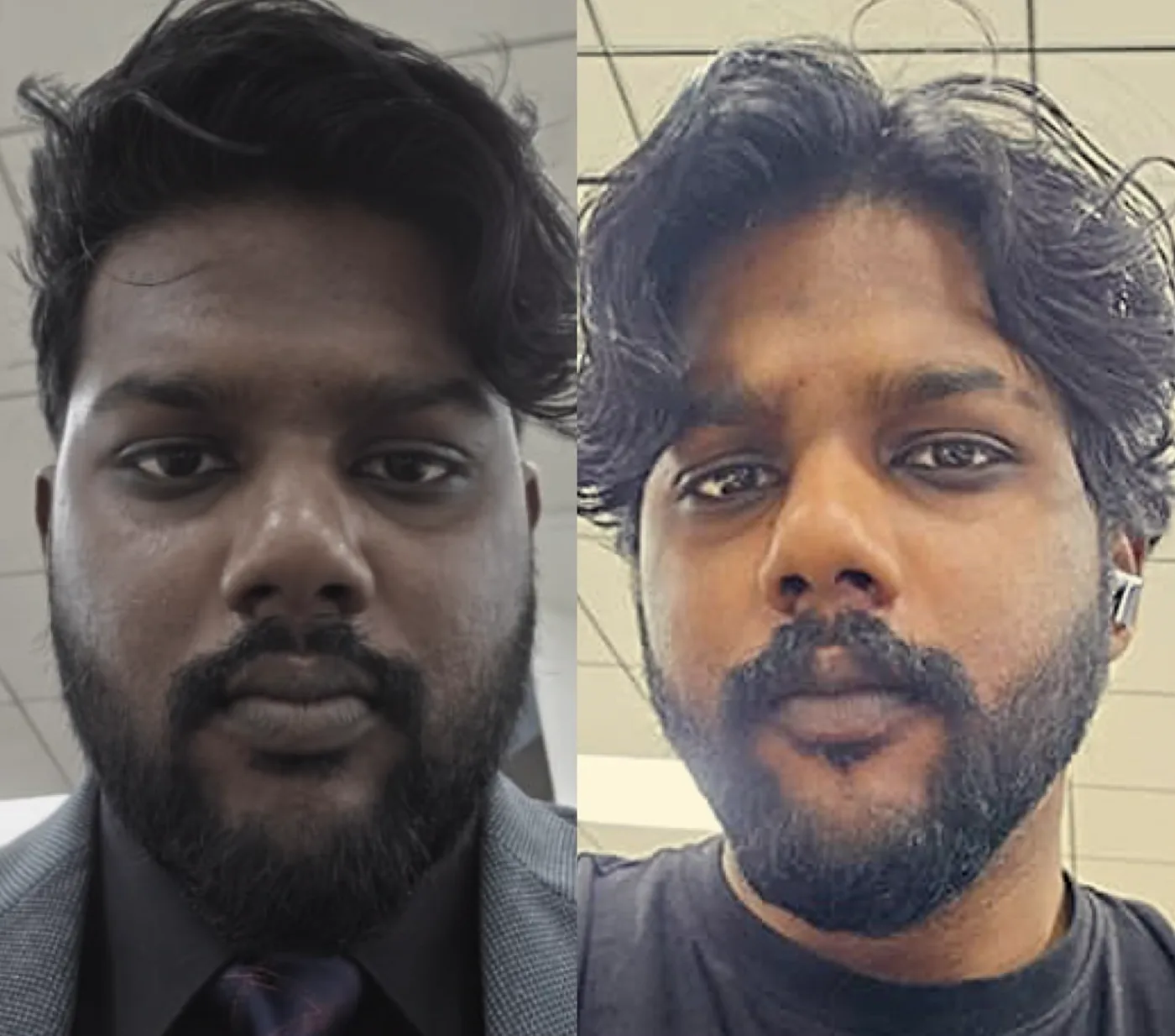 Client before and after transformation photo