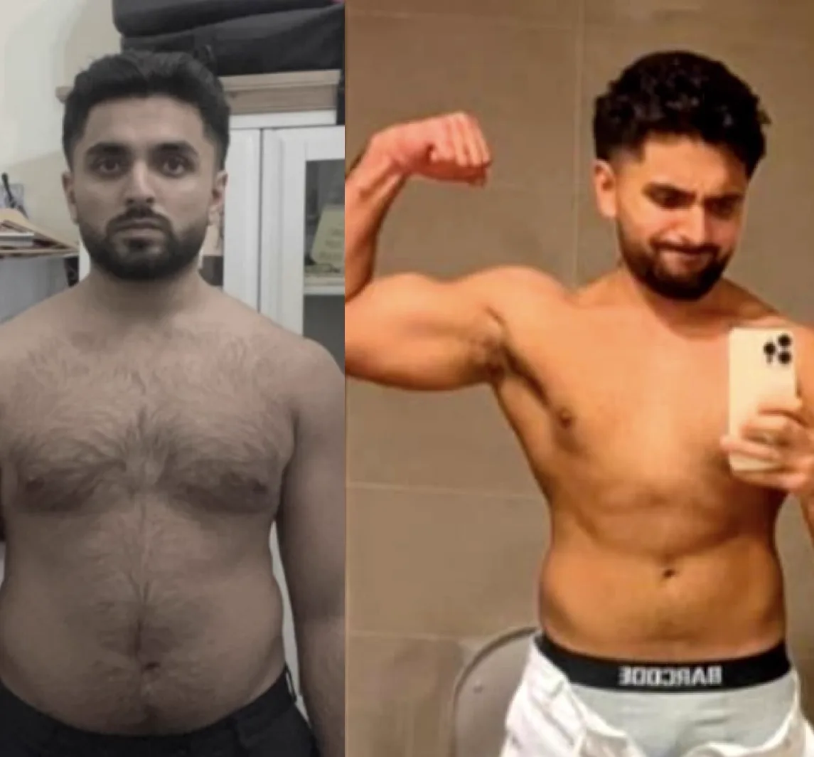 Client before and after result photo